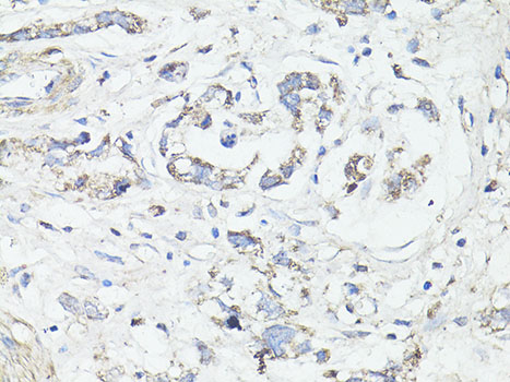 A15591_IHC_02_(23575).jpg