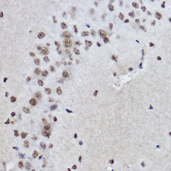A18687_IHC_03_(1080526).jpg